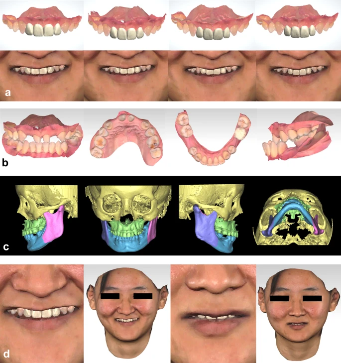 Stomatologiyada Rəqəmsal Diaqnostika
